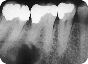 QE05_Horner_i-161_fig122a.jpg