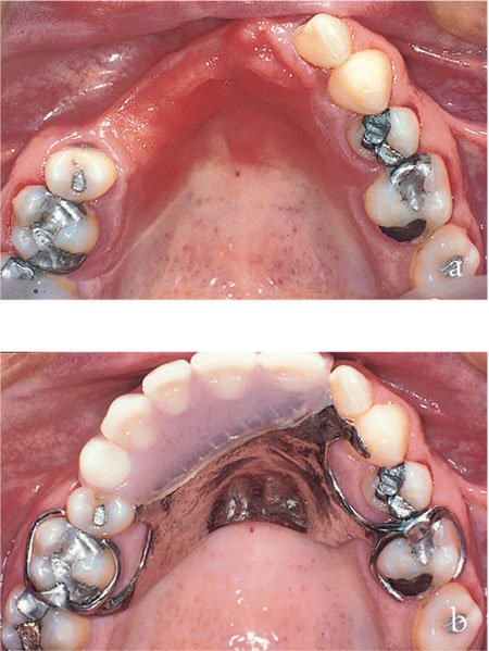 QE07_Allen_fig096a.jpg