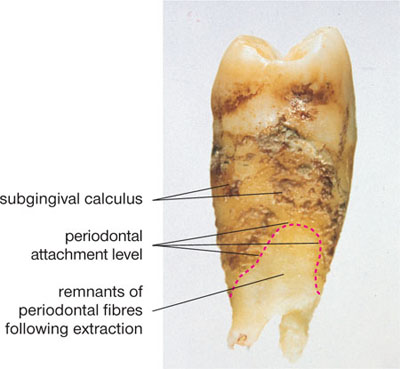 QE17_Clerehugh_fig060.jpg