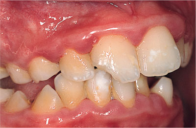 QE17_Clerehugh_fig081b.jpg