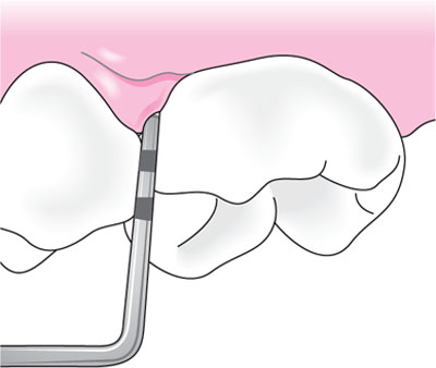 QE17_Clerehugh_fig085b.jpg