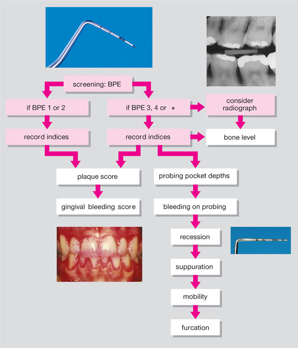 Periodontal Treatment Phases 5806