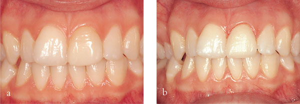 QE19_Brunton_fig084b.jpg