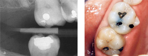 QE25_Bartlett_fig004b.jpg