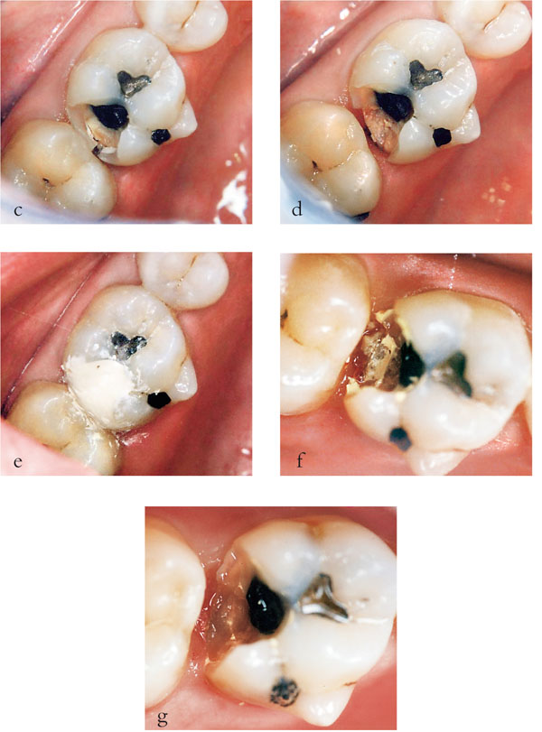 QE25_Bartlett_fig005.jpg