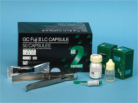 Conventional glass on sale ionomer cements