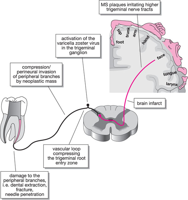 QE37_Murphy_fig084.jpg