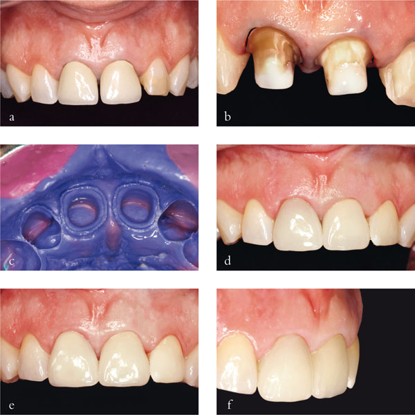 QE40_Mannocci_fig040.jpg