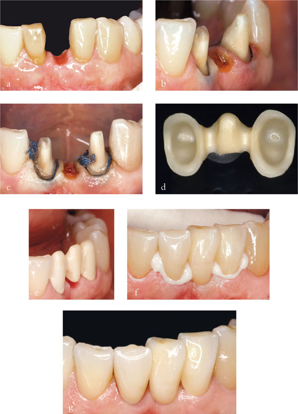 QE40_Mannocci_fig041.jpg