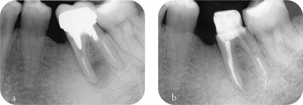 QE40_Mannocci_fig074.jpg