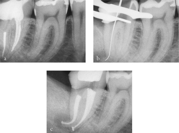 QE40_Mannocci_fig090.jpg