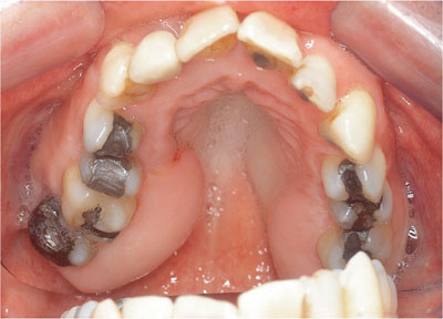 QE43-44_Chapple_fig107a.jpg