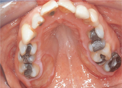 QE43-44_Chapple_fig108a.jpg