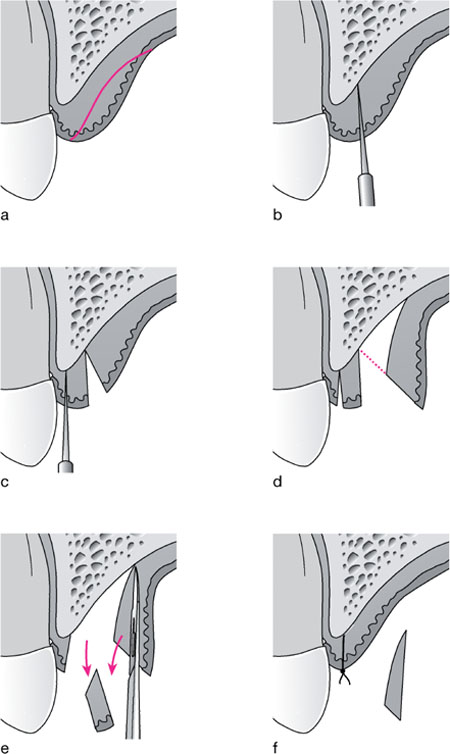 QE43-44_Chapple_fig109.jpg