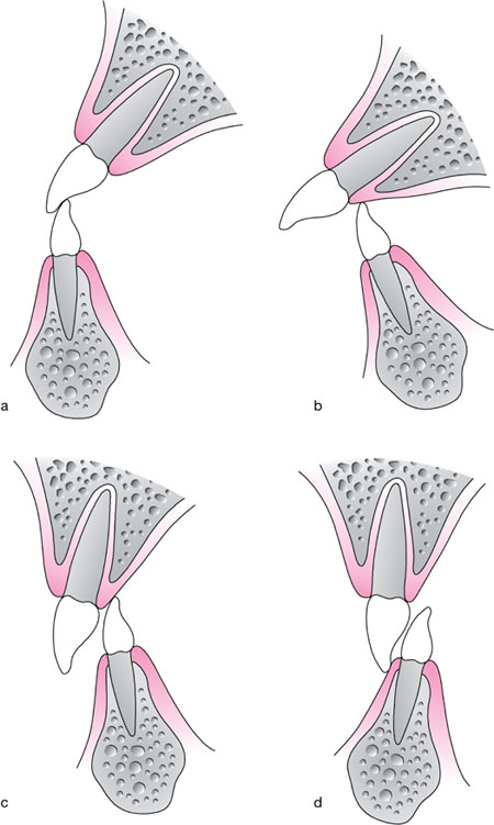 QE43-44_Chapple_fig168.jpg