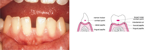 QE43-44_Chapple_fig187b.jpg