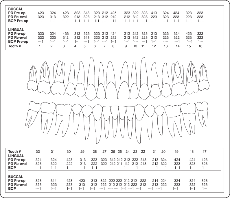 Dental Pocket Depth Chart