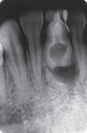 2 Deviations in Tooth Morphology and Size | Pocket Dentistry