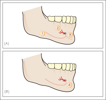 incisive canal mandible