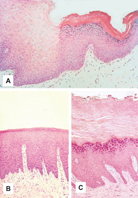 nonkeratinized stratified squamous epithelium mouth