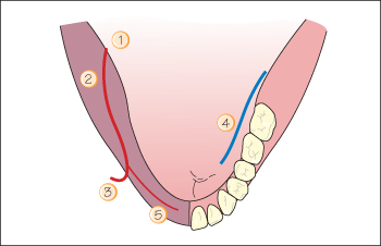 Mandibular foramen: Anatomy and contents