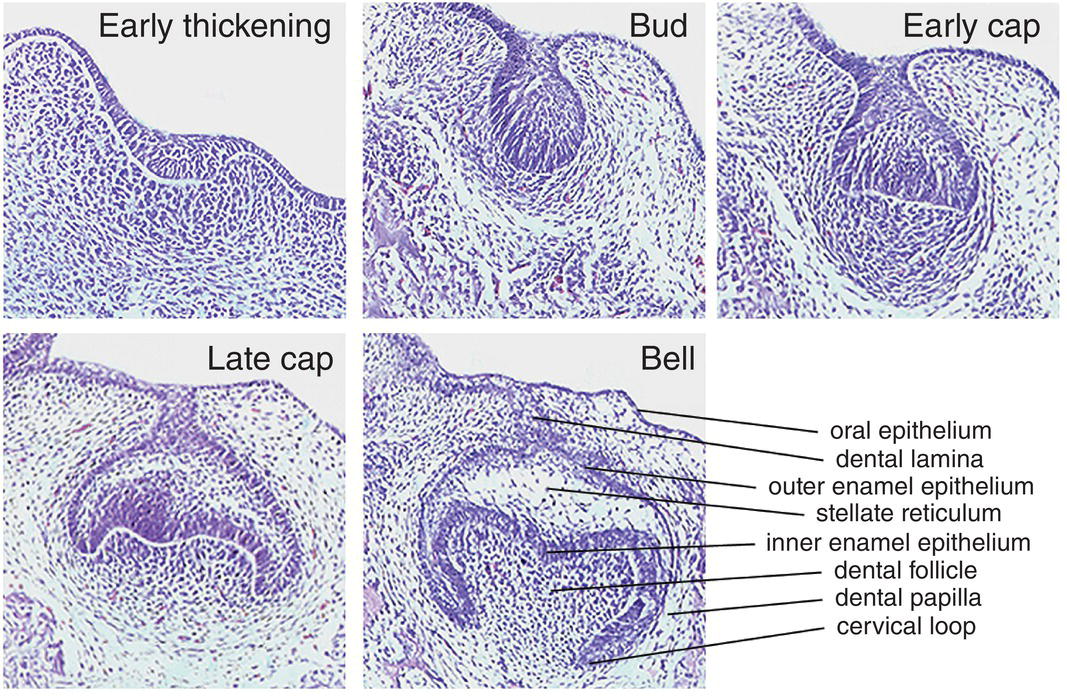 Tooth Development Histology Diagram Bell Stages Maula - vrogue.co