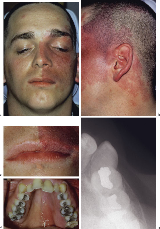 4 Examination Of The Head And Neck Pocket Dentistry