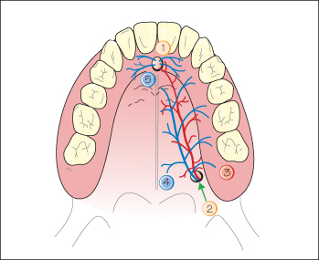 palatine nerve