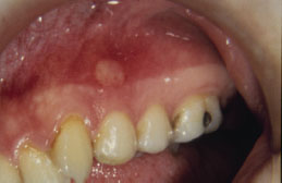 5: Examination of Oral Cavity | Pocket Dentistry