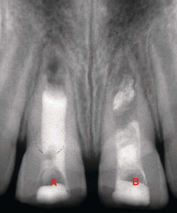 c5-fig-0006