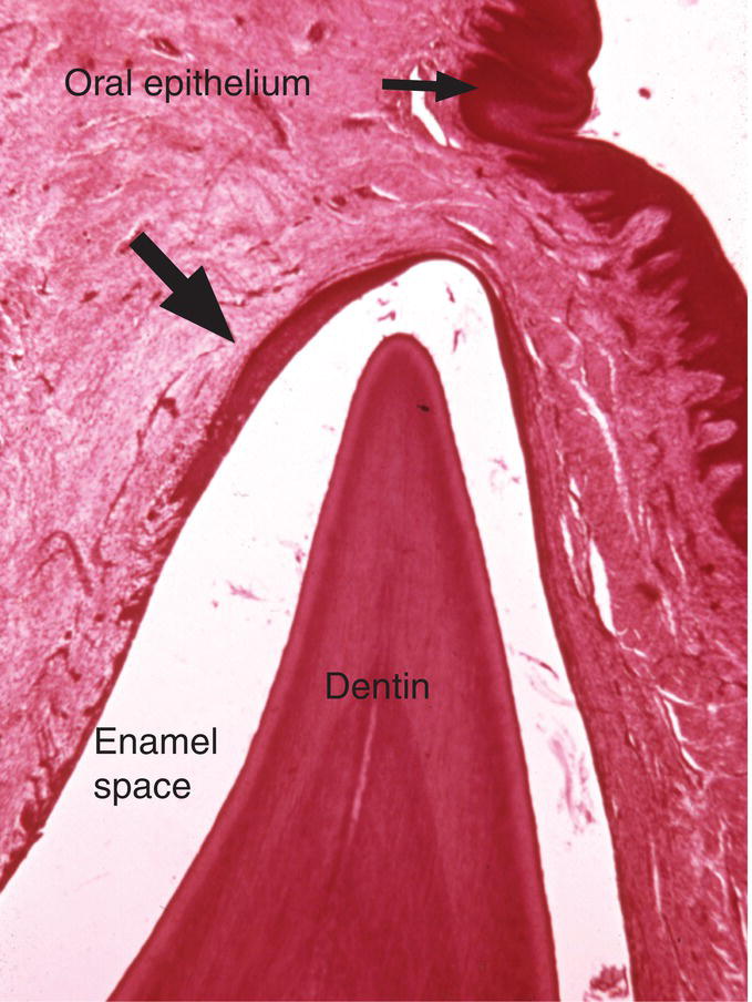 7: Tooth Eruption and Shedding | Pocket Dentistry