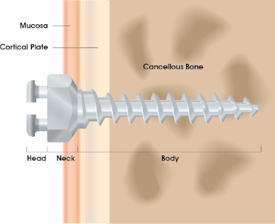 c1-fig-0001