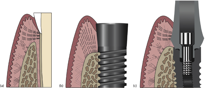 c1-fig-0001