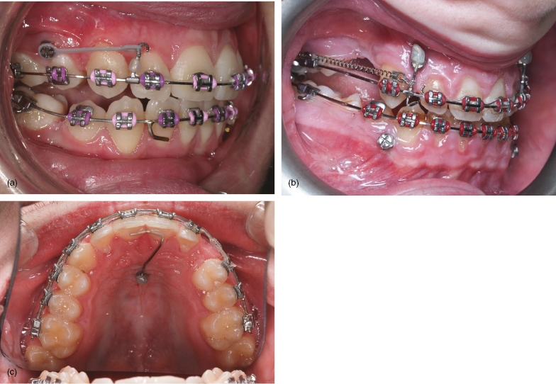 c1-fig-0002