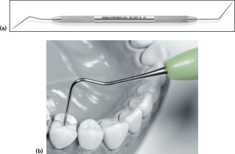 k files in endodontics