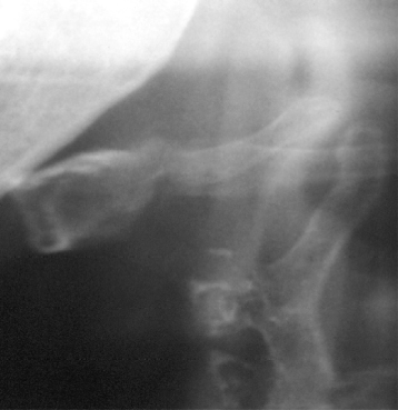 MANDIBULA RADIOPACA COM TODOS OS DENTES PARA CRANIO 9001 - cód. 12285