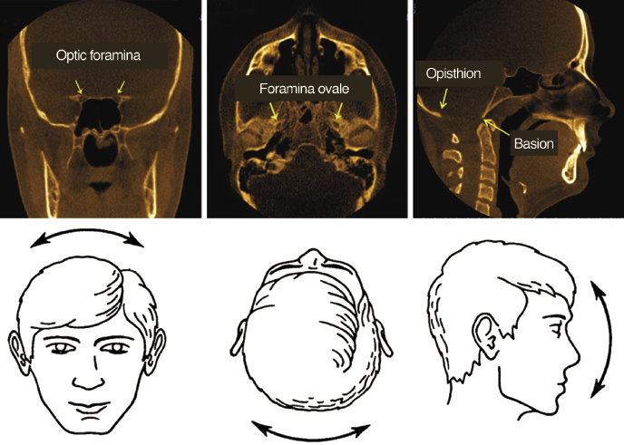 c11-fig-0001