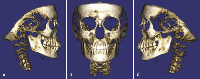 c11-fig-0002