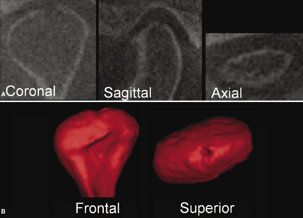 c12-fig-0001