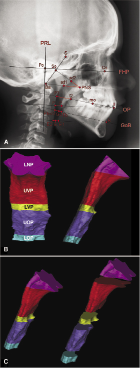 c13-fig-0001