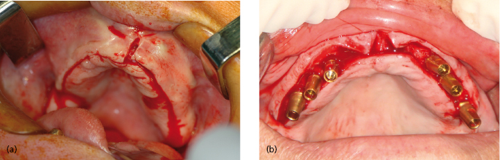 c13-fig-0002