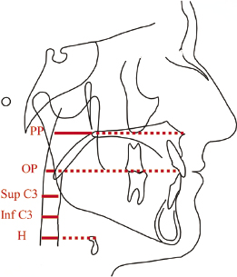 c13-fig-0003