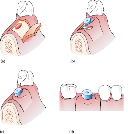 c13-fig-0004