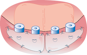 c13-fig-0005