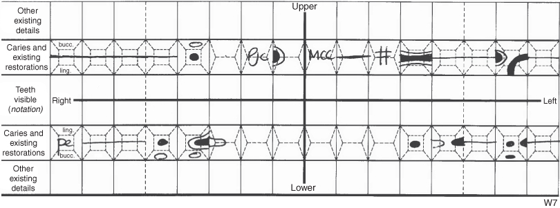 Fdi Notation Charting