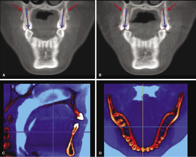 c14-fig-0001