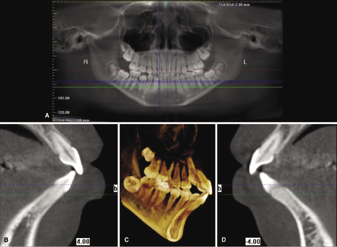 c14-fig-0002