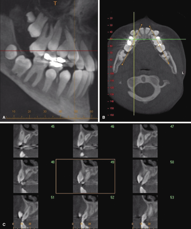 c14-fig-0003