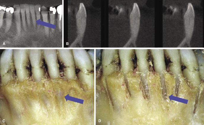 c14-fig-0004