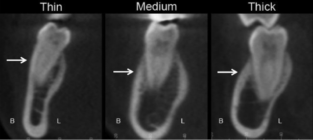 c14-fig-0005